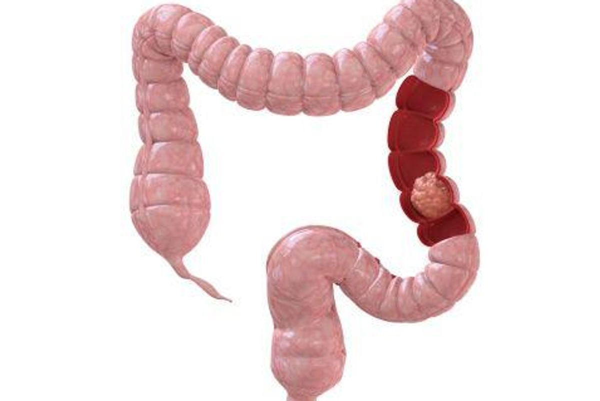 picture of a colon
