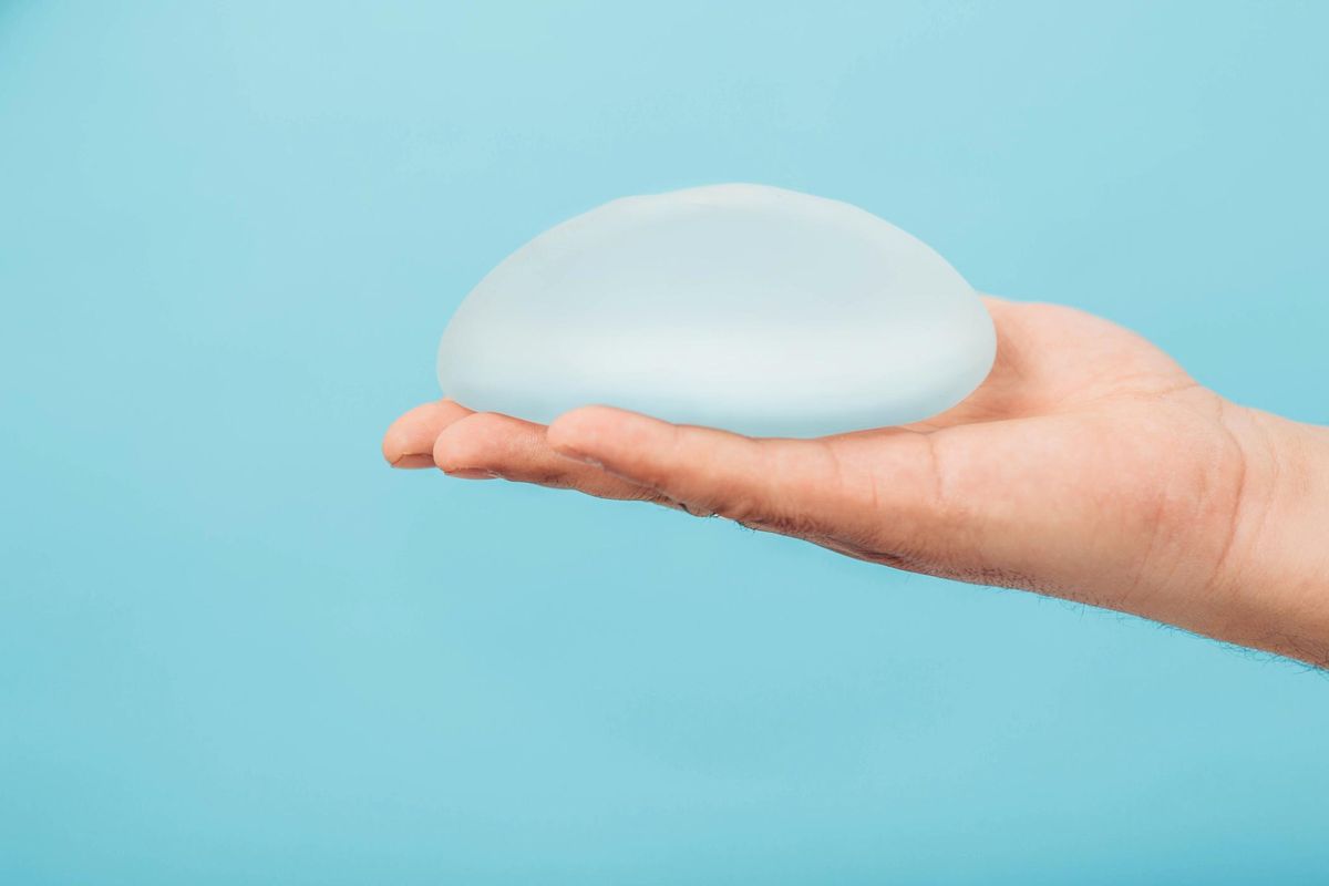plastic surgeon holding breast silicone implant as an Option for Breast Reconstruction