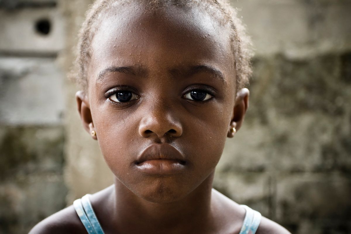 Poor and Minority Children With Food Allergies Overlooked and in Danger