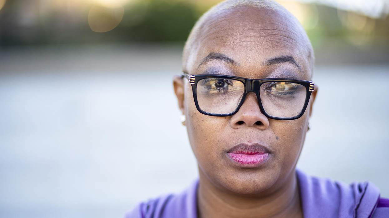 What Is Alopecia? It’s No Laughing Matter for Millions of Black American Women