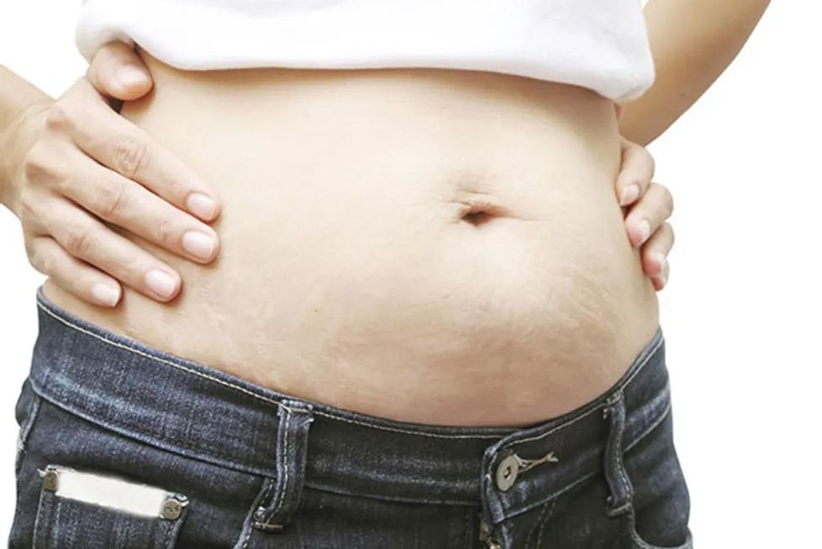 post-pregnancy weight gain