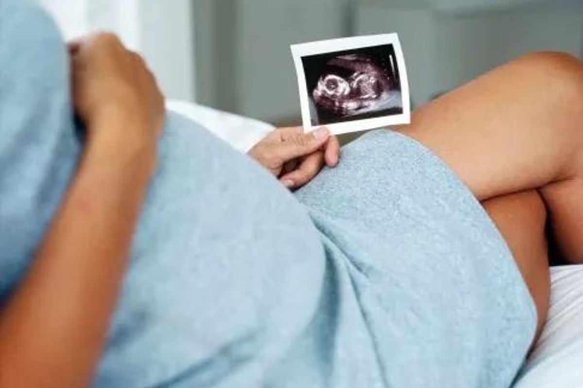 pregnant woman holding a picture of an ultrasound