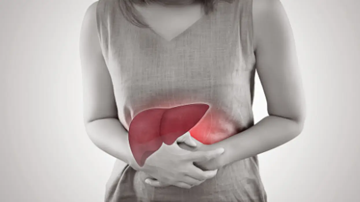 Primary Biliary Cholangitis (PBC)
