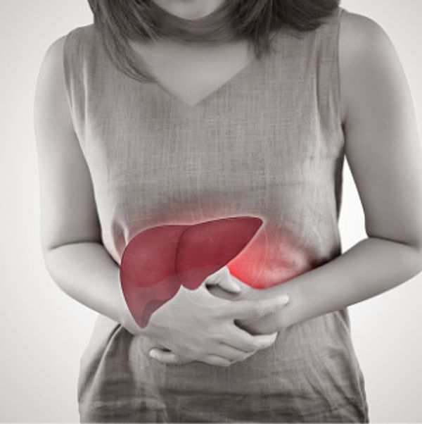 Primary Biliary Cholangitis (PBC)