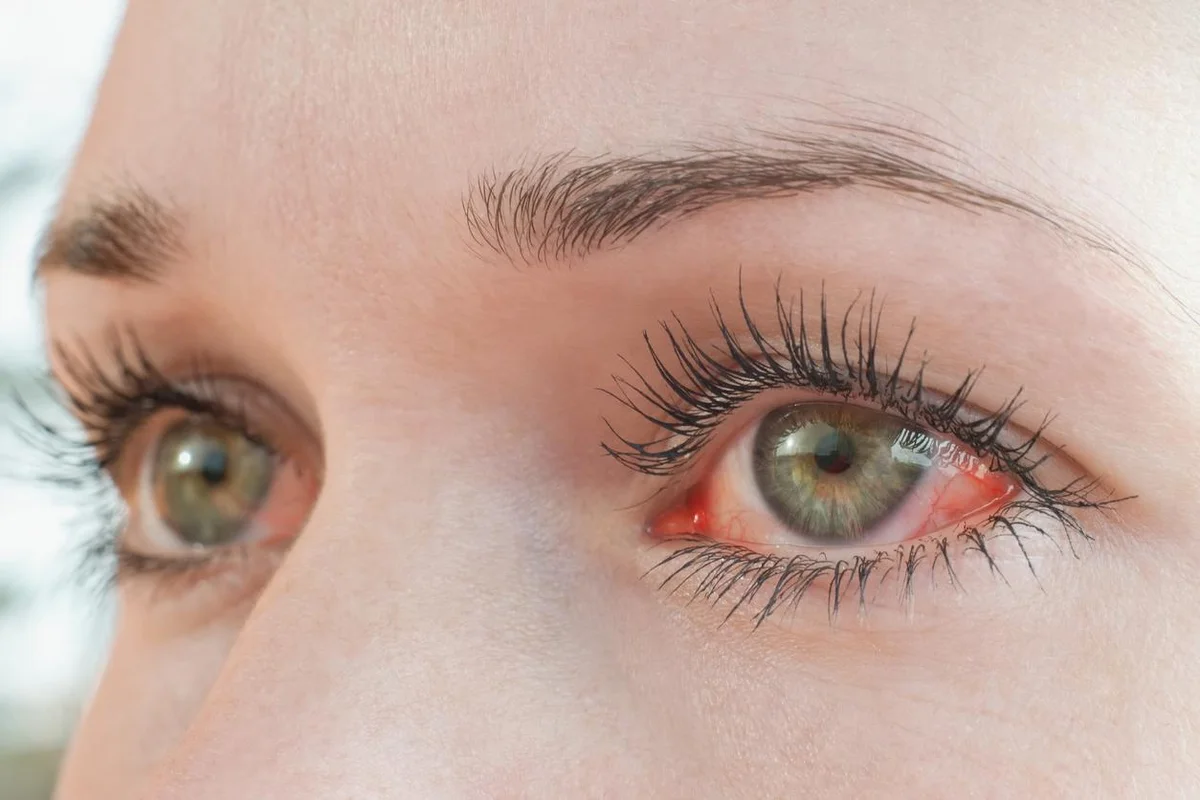 Red irritated human eye close up