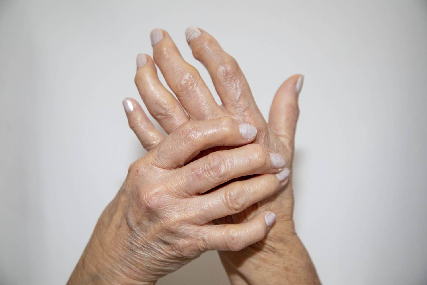Rheumatoid Arthritis 101
