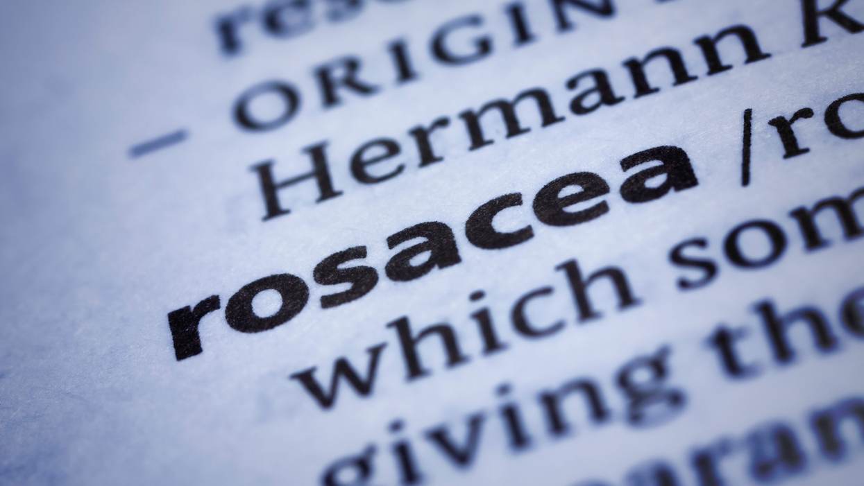 Rosacea: What is it? What can you do about it? How can you cover it up?