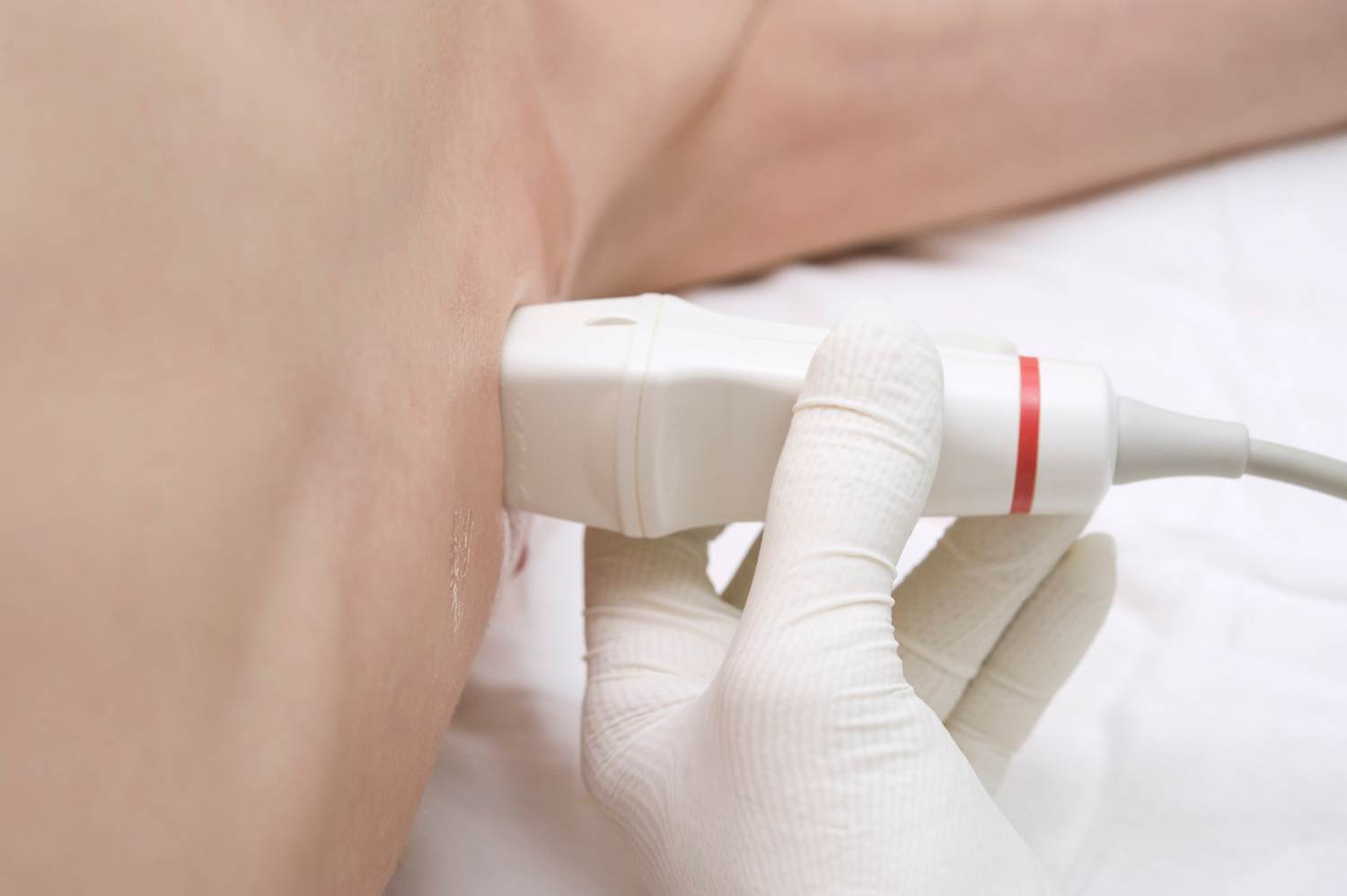 Difference Between Breast Lumps and Masses