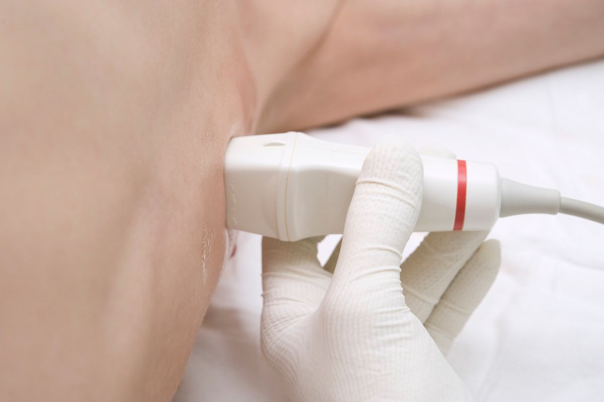 Scanning with ultrasound