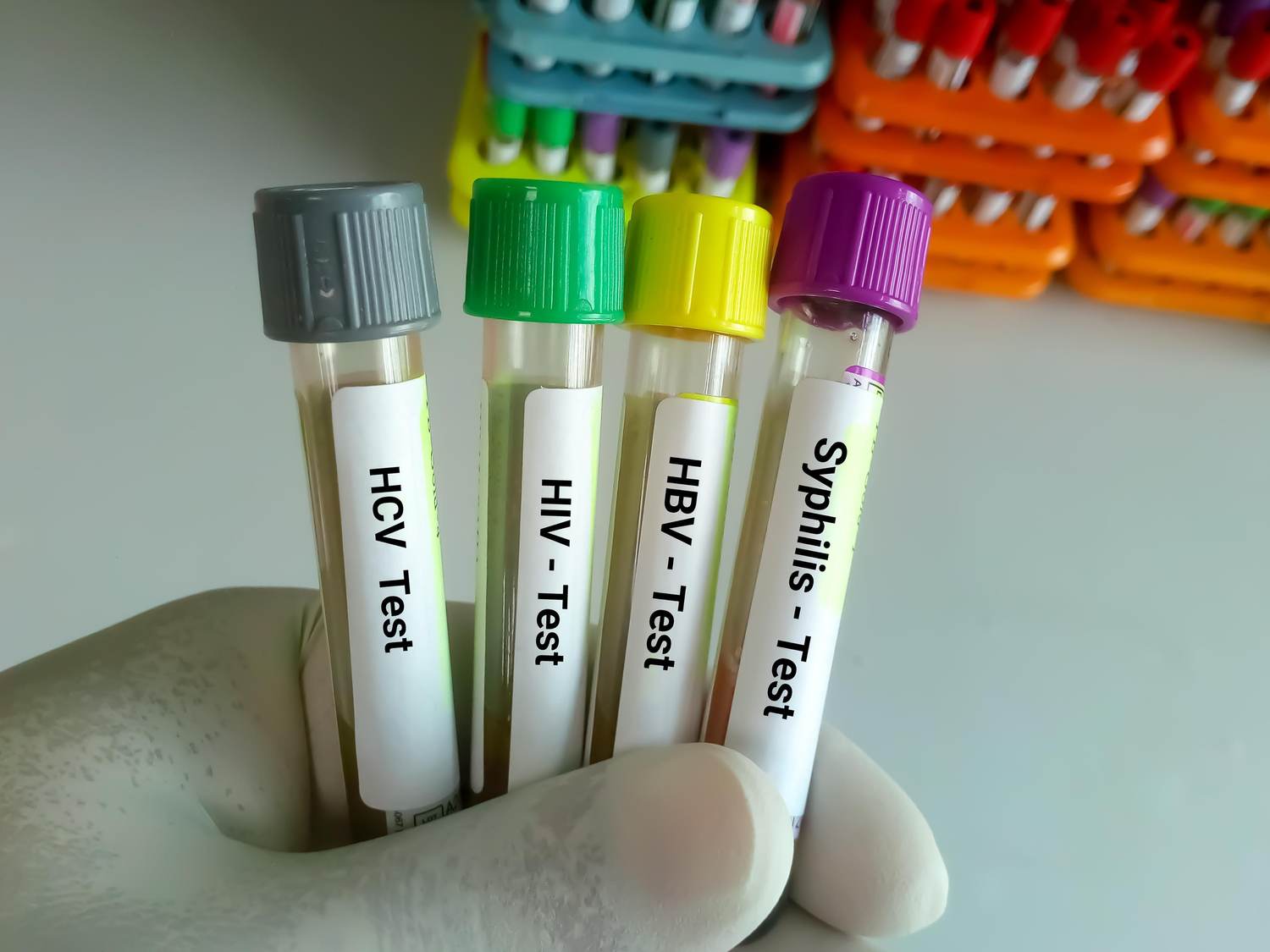 Why Did Sexually Transmitted Infections Go up During the Pandemic — and What Can We Do About It?