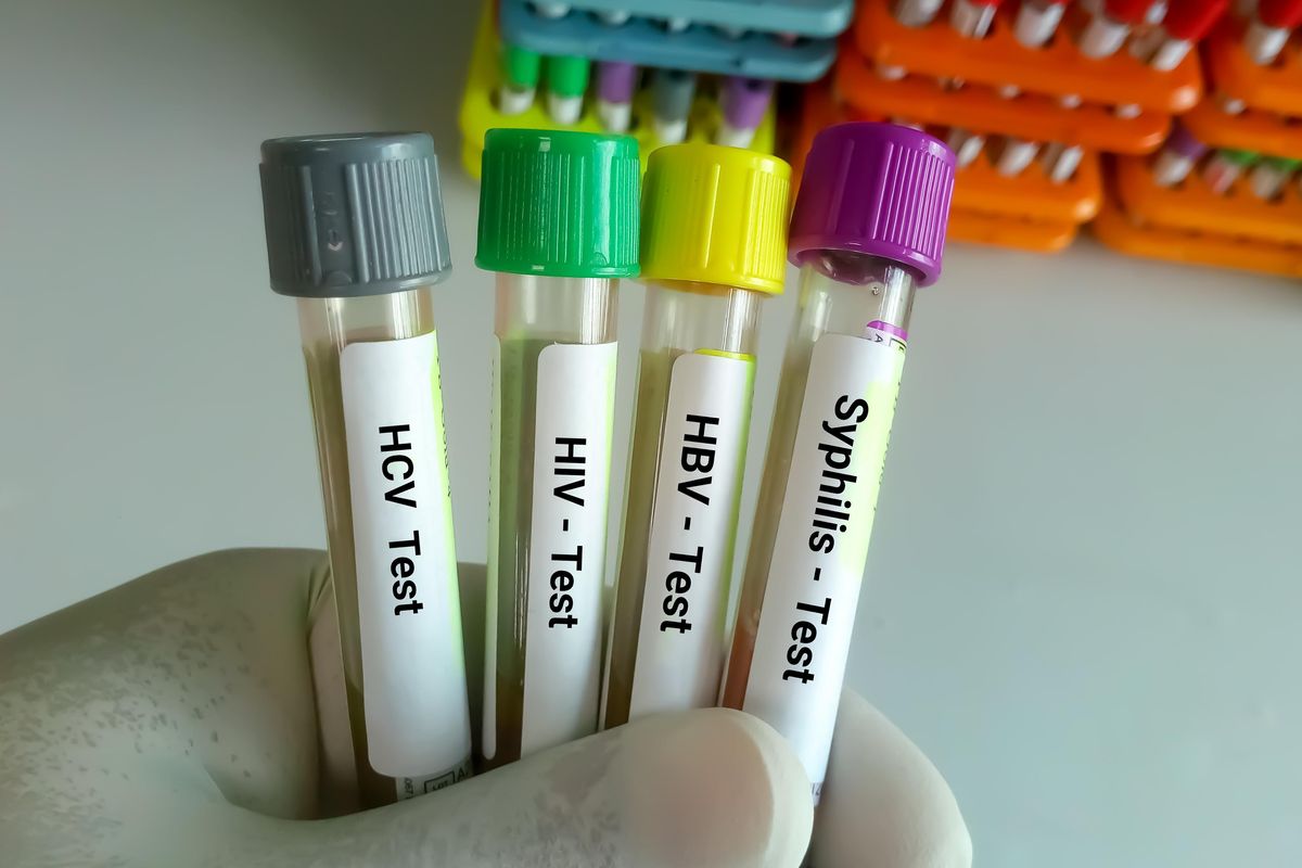 Scientist hold blood samples tube for Sexually Transmitted Disease. Syphilis, HBV, HIV, HCV