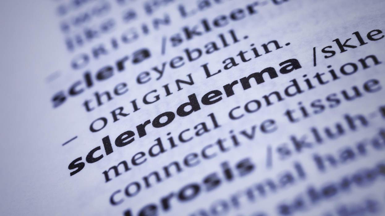 What is Scleroderma