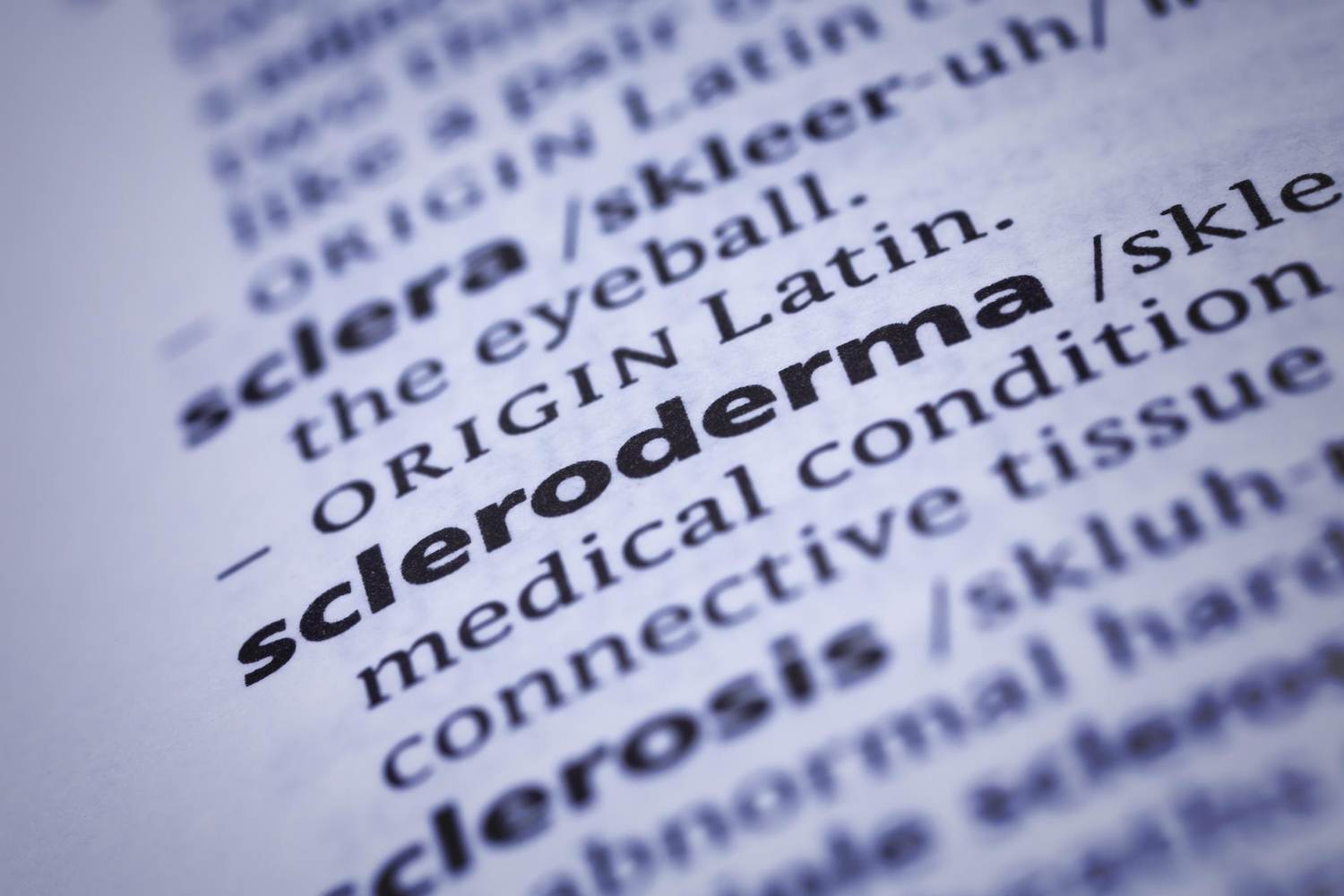 What is Scleroderma