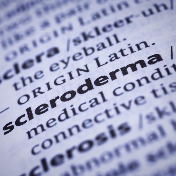 Scleroderma: Dictionary Close-up