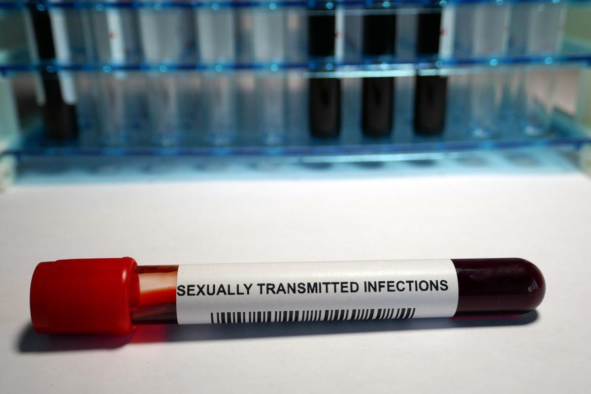 Sexually transmitted infection - laboratory analysis performed on a blood sample