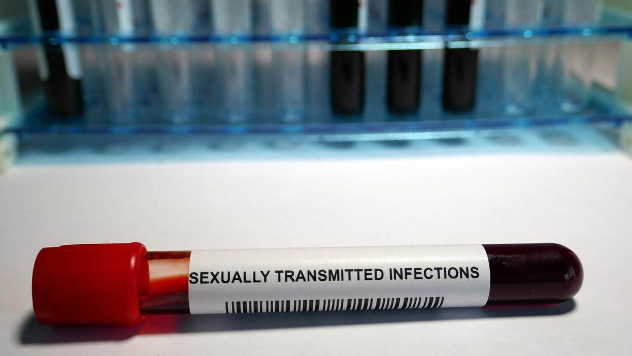 You Can Test Yourself for an STI at Home — but Should You?