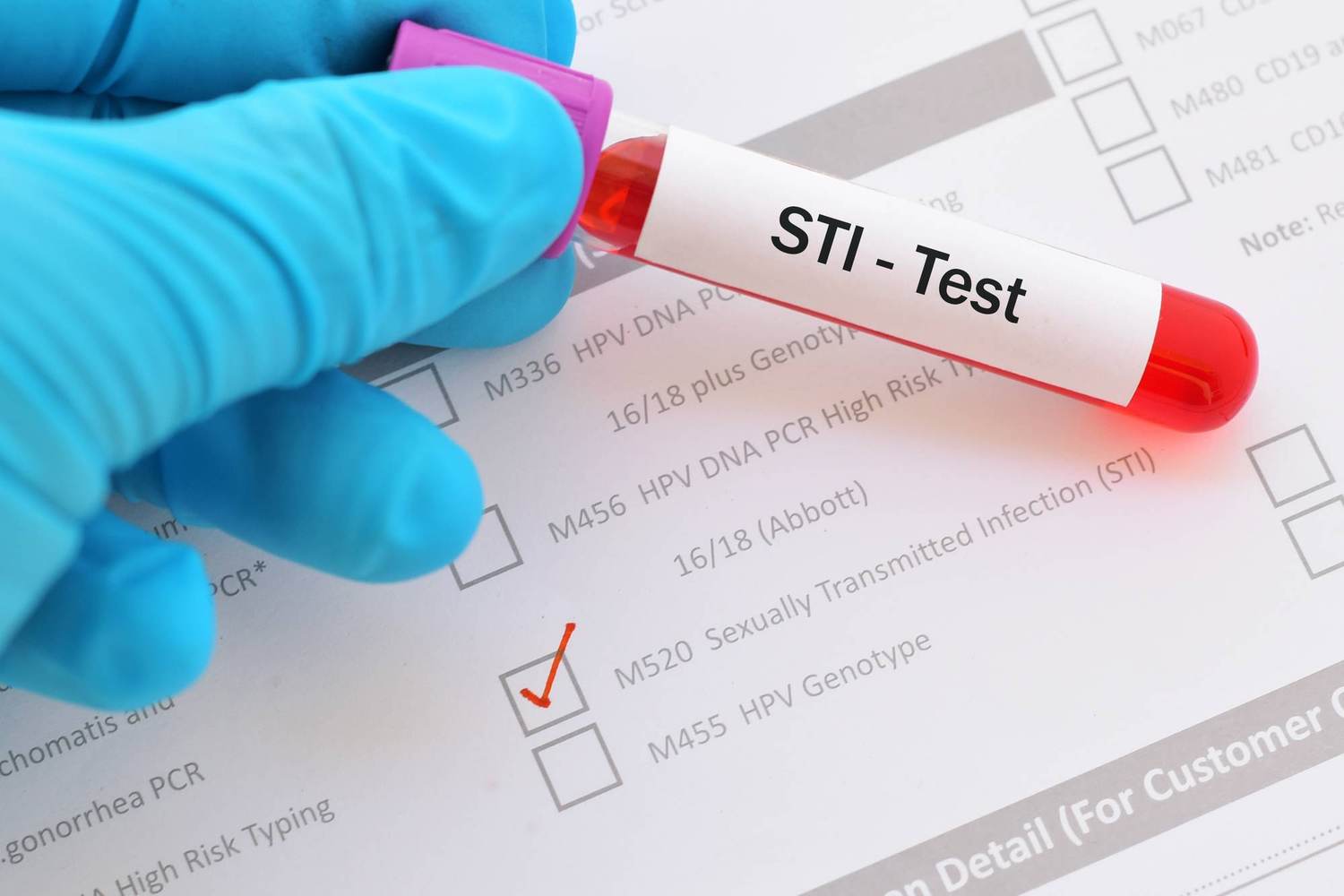 FAQs About STI Testing