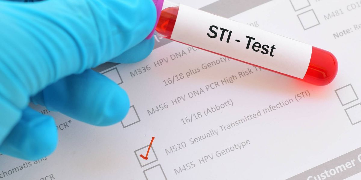 FAQs About STI Testing