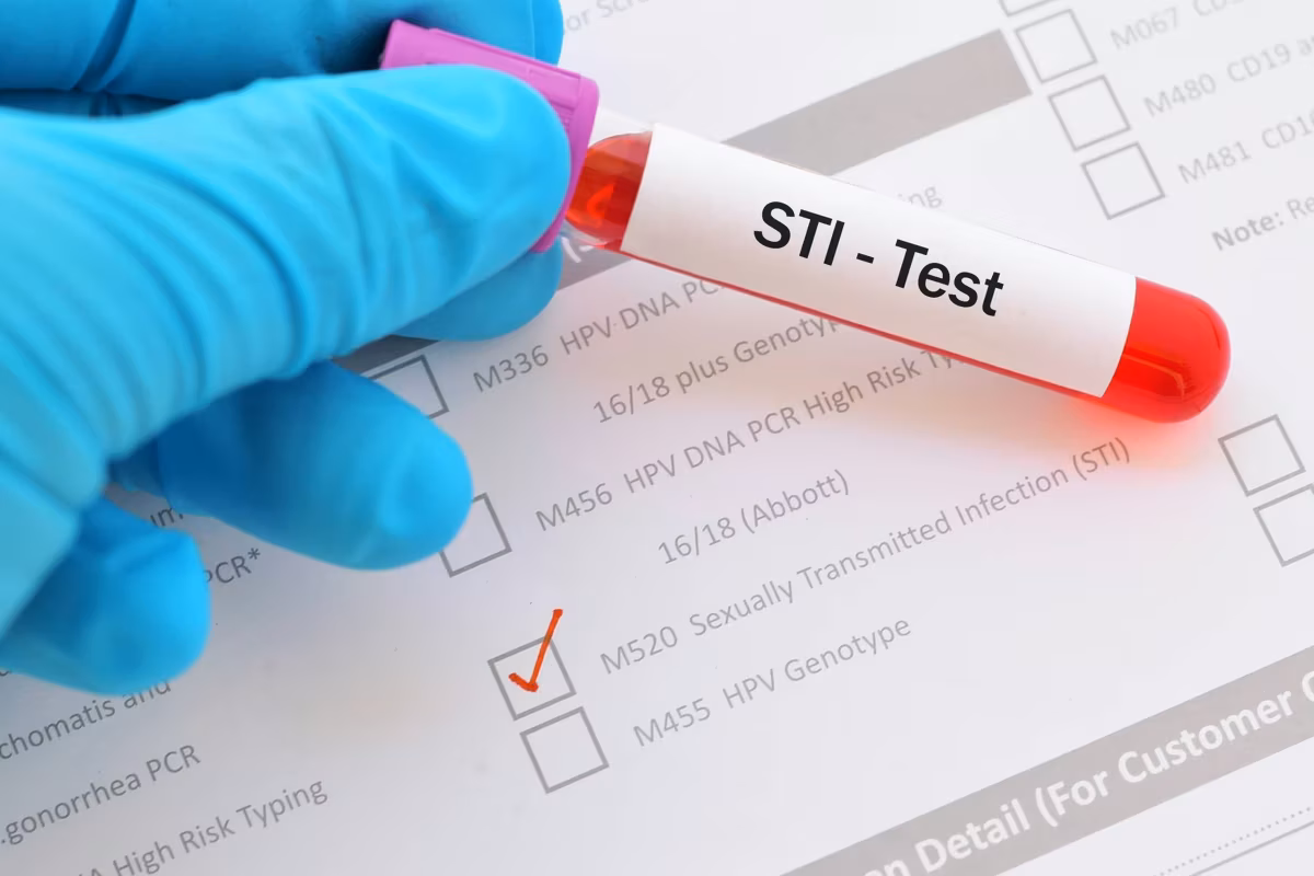 Sexually transmitted infection (STI) test
