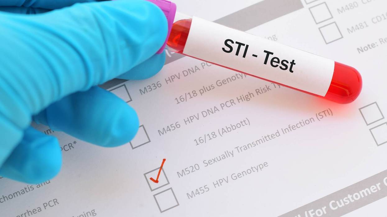 FAQs About STI Testing