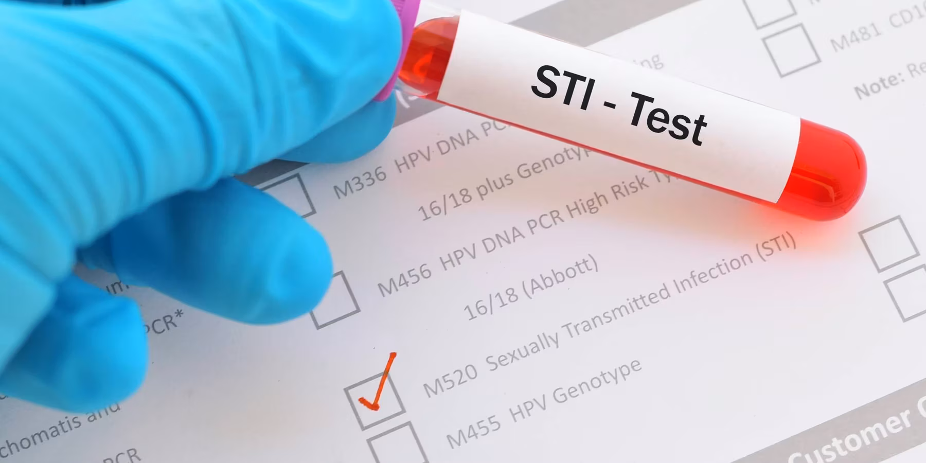Sexually transmitted infection (STI) test