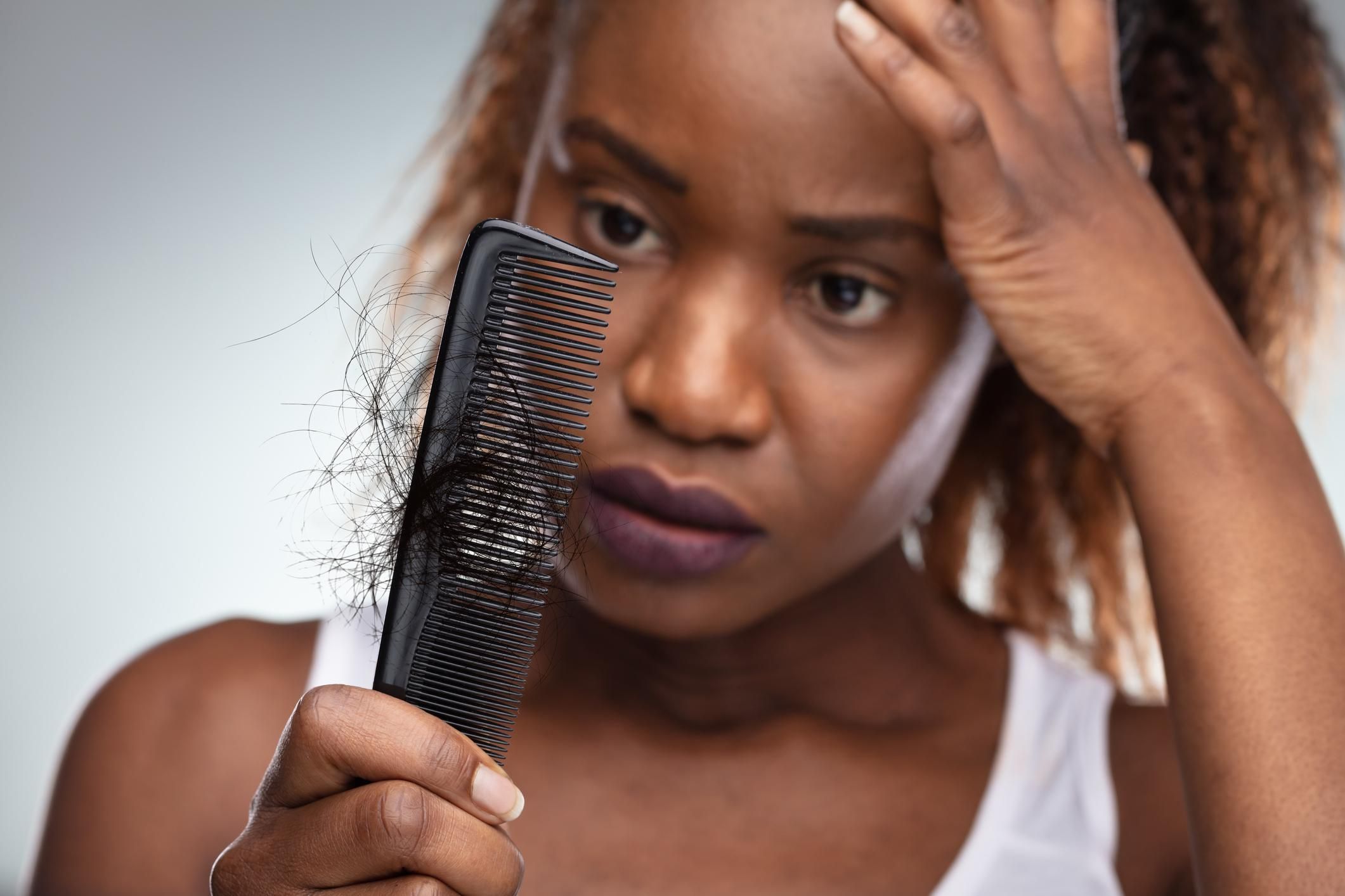 Shocked Woman Suffering From Hair Loss