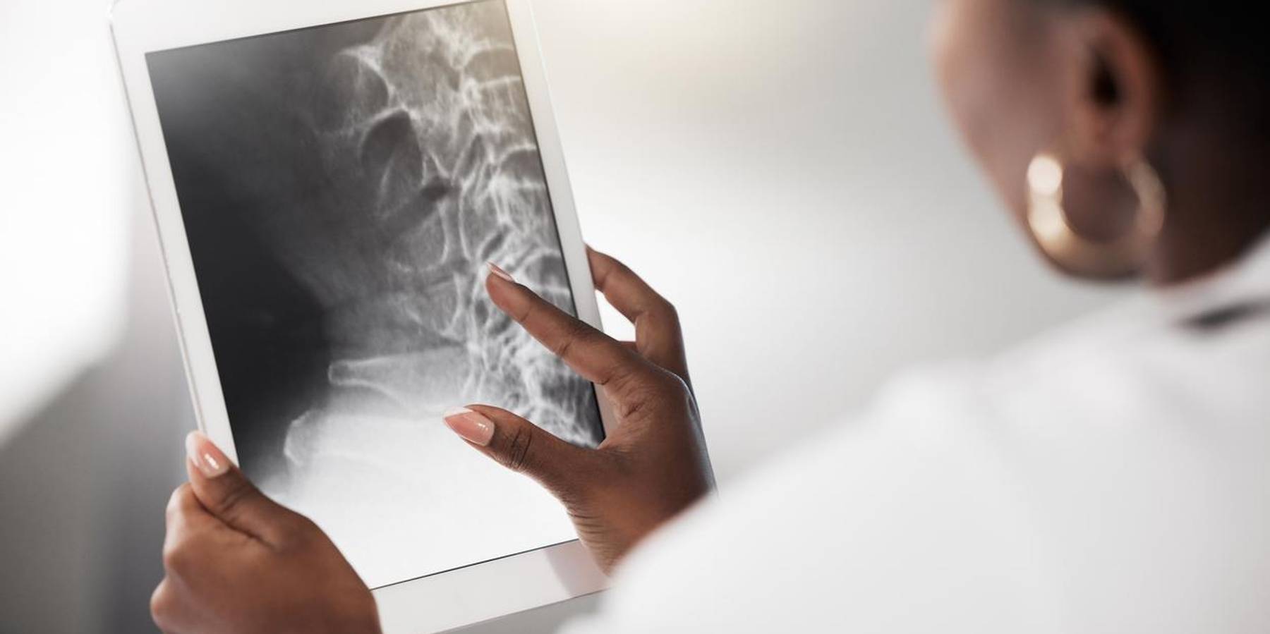 Shot of a doctor analysing an x ray