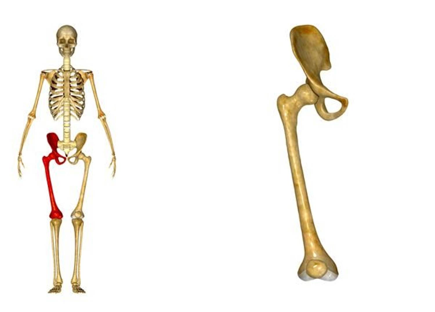 The Boom in Boomer Hip Replacements