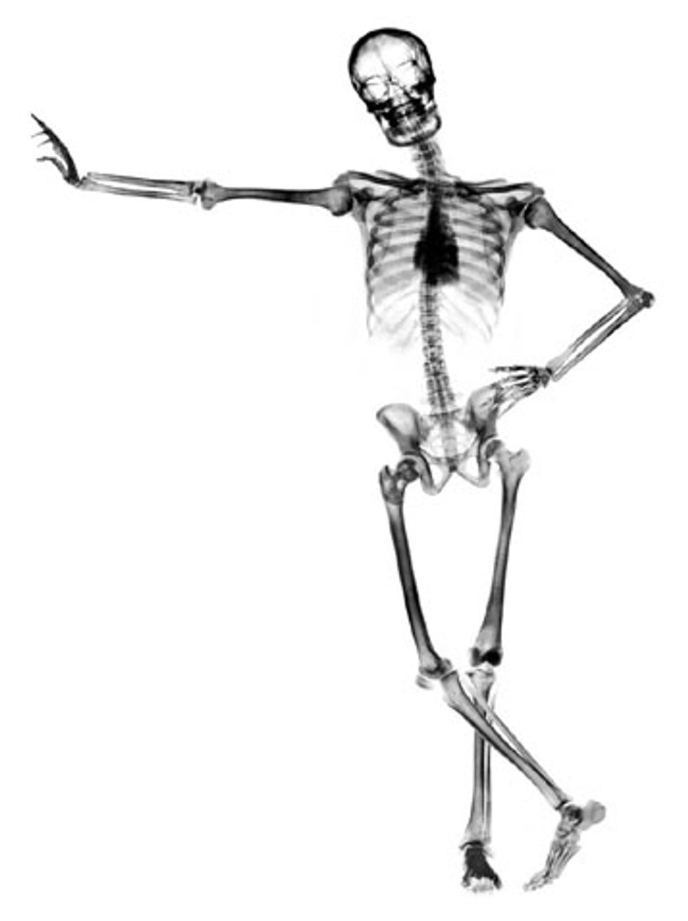 skeleton