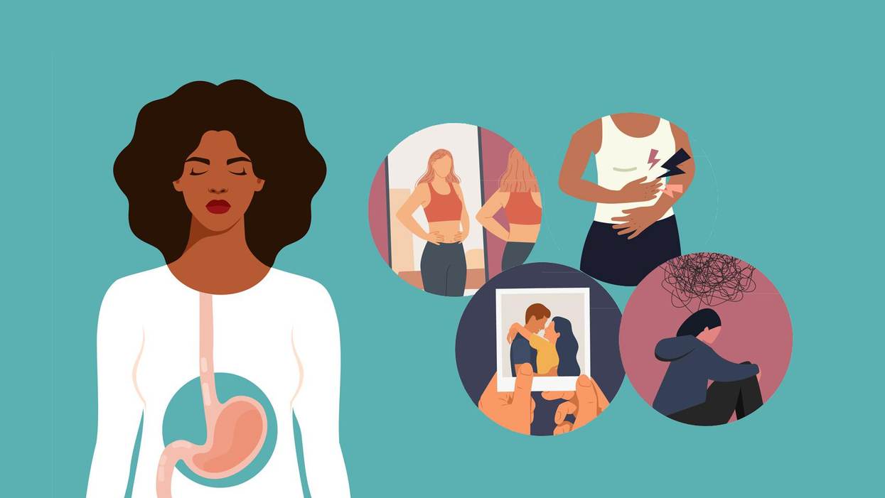 Social and Emotional Effects of Life With Inflammatory Bowel Disease (IBD)