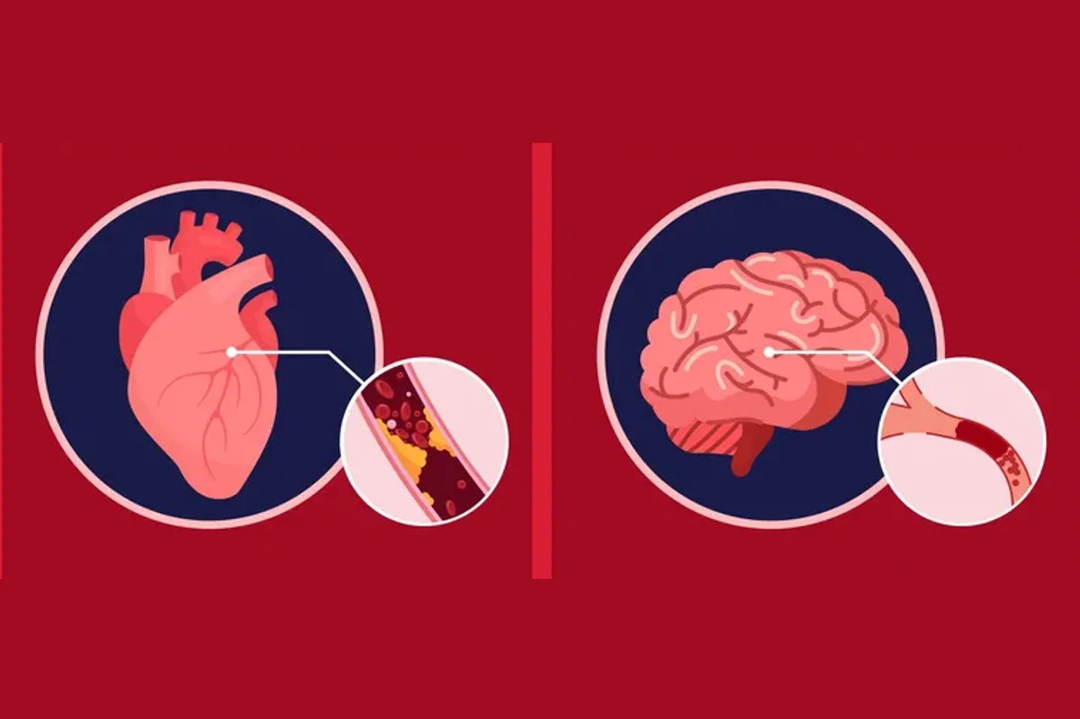 Stroke vs. Heart Attack Know the Signs & Symptoms HealthyWomen