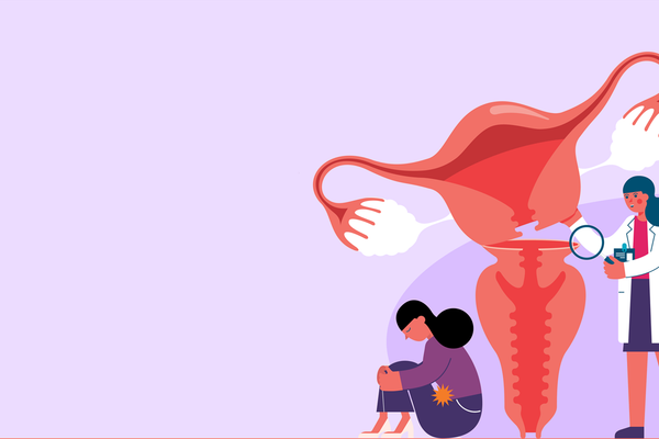 Surgical Options for Fibroids