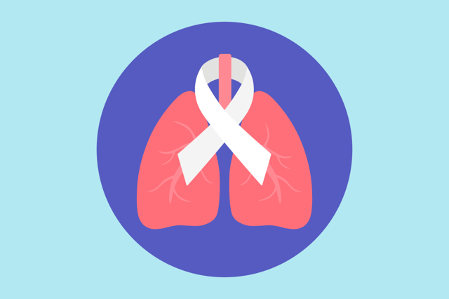 Síntomas de cáncer pulmonar