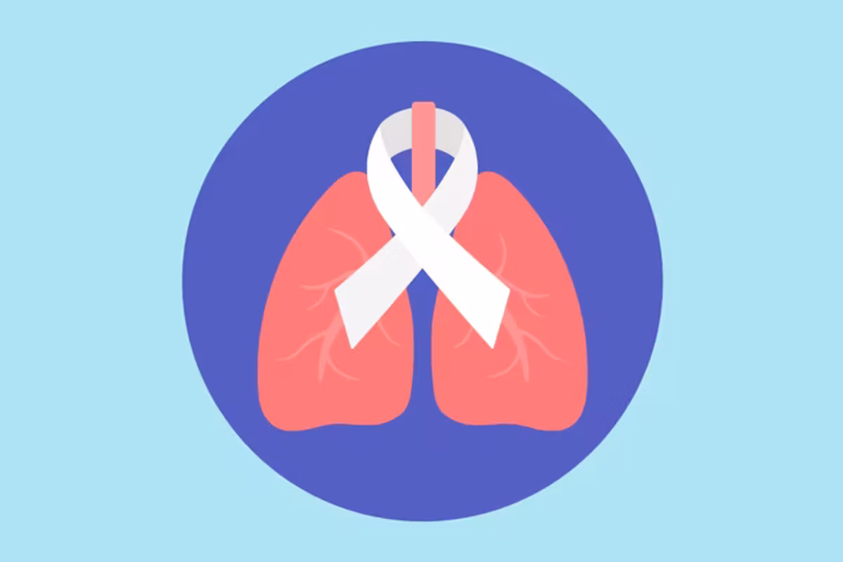 Symptoms of Lung Cancer