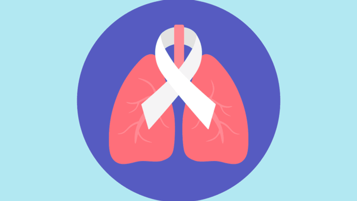 Síntomas de cáncer pulmonar