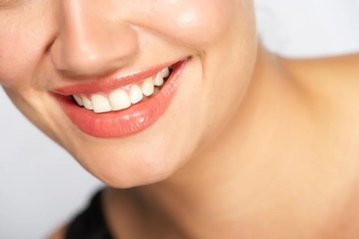 Teeth Whitening Best Bets: DIY vs. Professional Treatments
