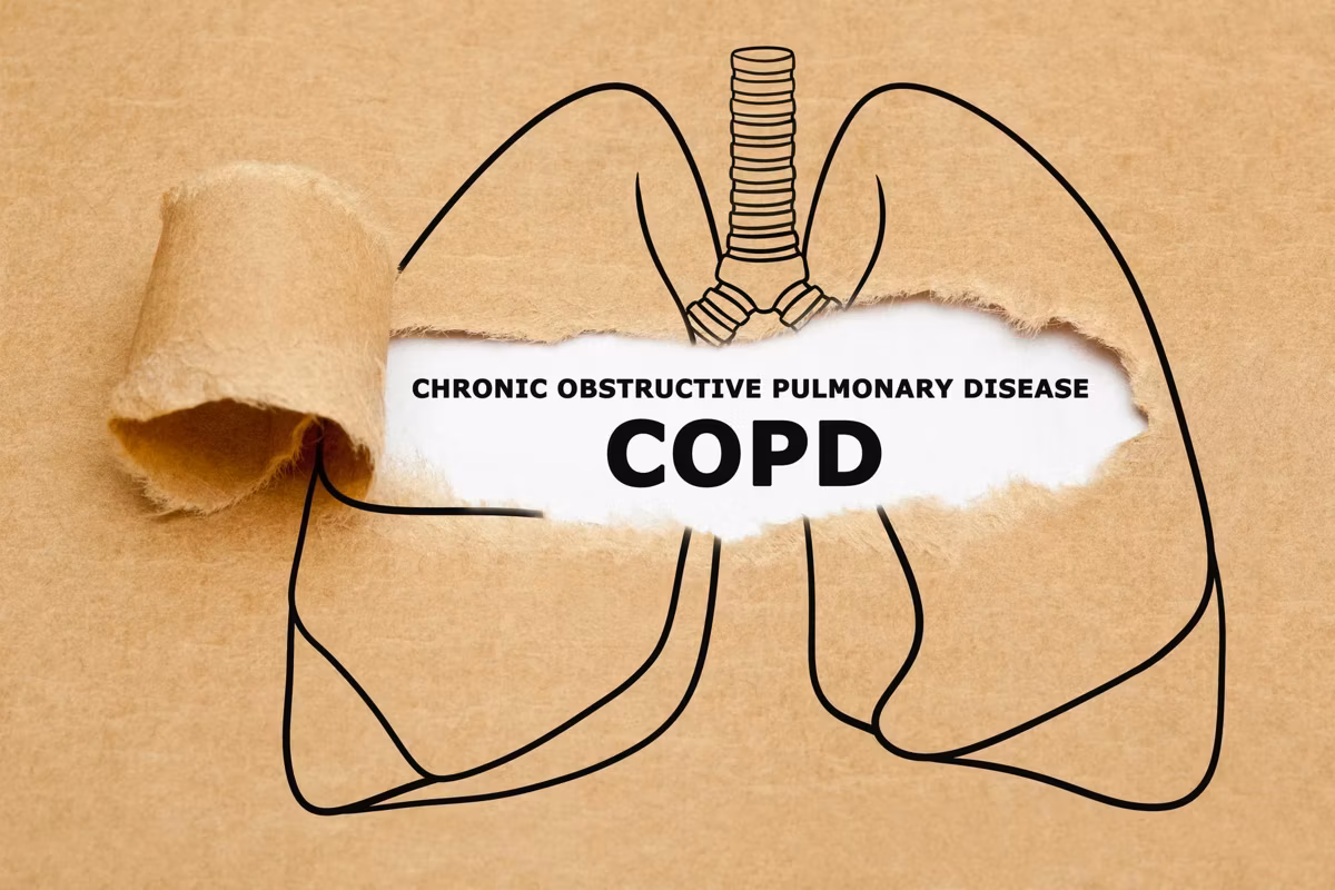 Text Chronic Obstructive Pulmonary Disease COPD appearing behind torn brown paper in human lungs drawing