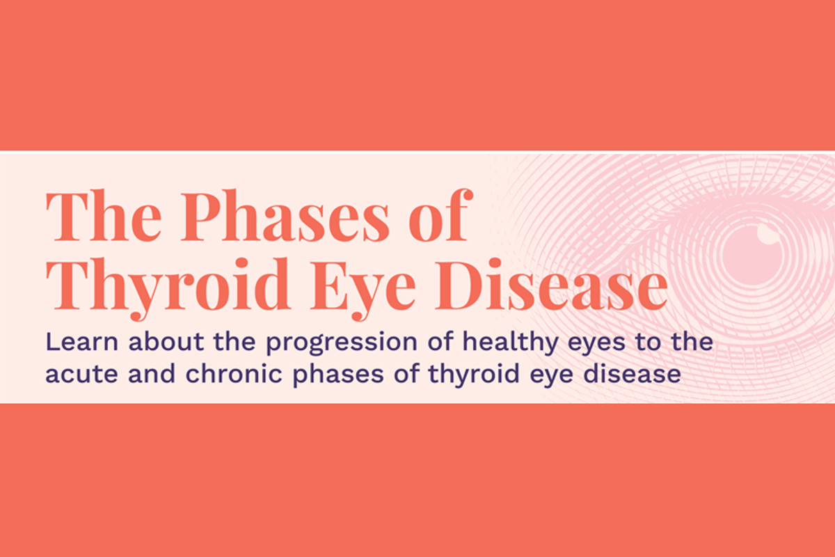 The Phases of Thyroid Eye Disease