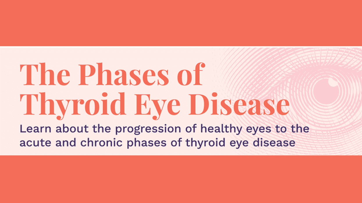 The Phases of Thyroid Eye Disease
