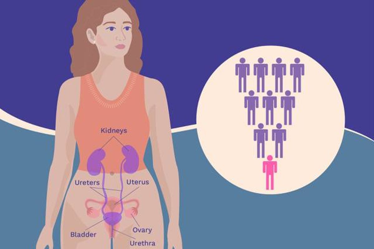 The Start and Spread of Urothelial Bladder Cancer infographic