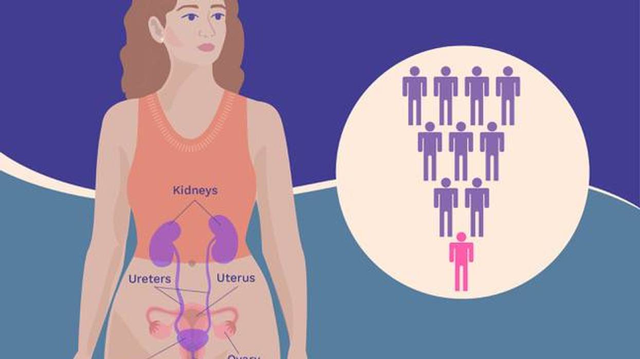 The Start and Spread of Urothelial Bladder Cancer