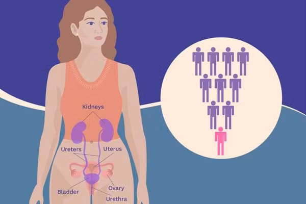 The Start and Spread of Urothelial Bladder Cancer infographic