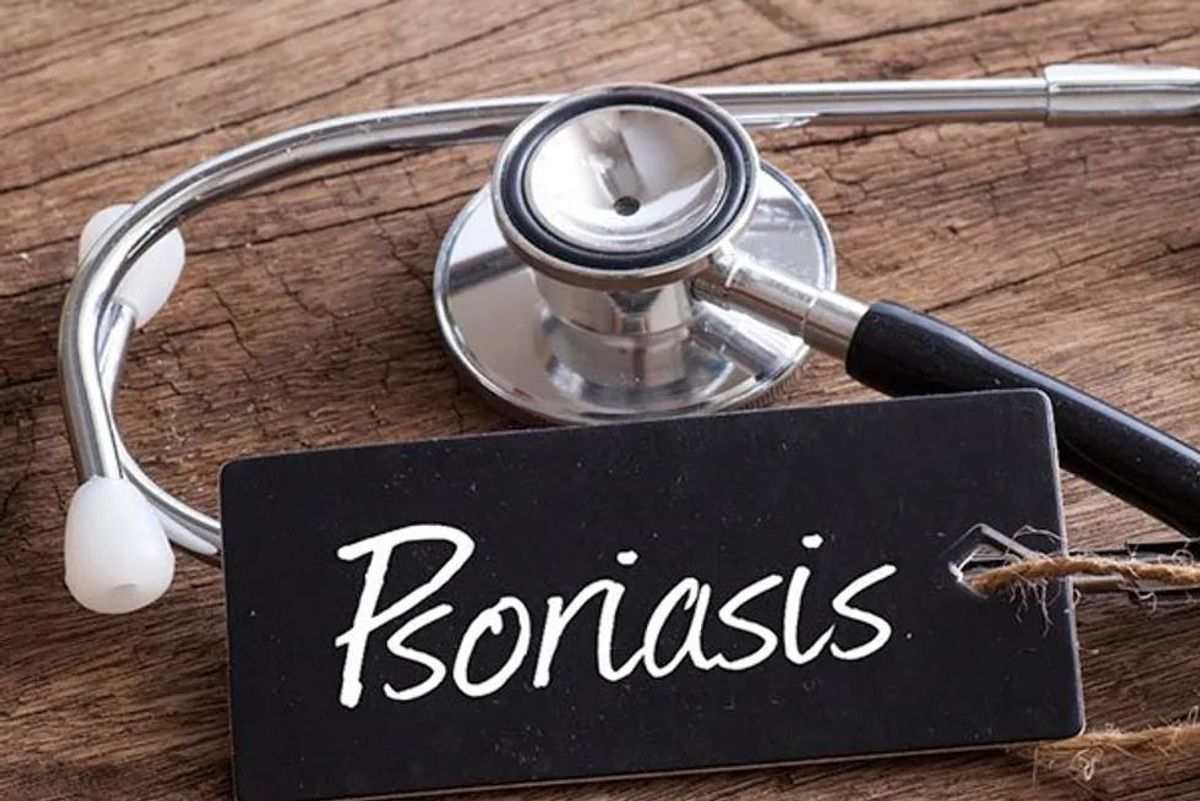 the word psoriasis
