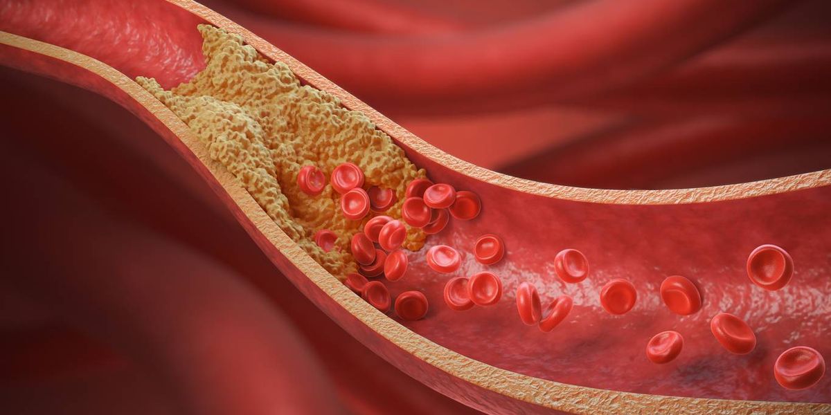 What Women Need to Know About Cholesterol