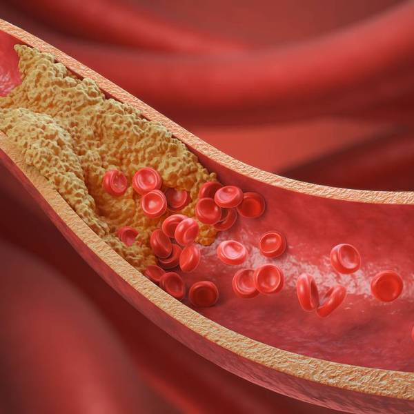 Thickened Arteries and Veins, Red Blood Cells