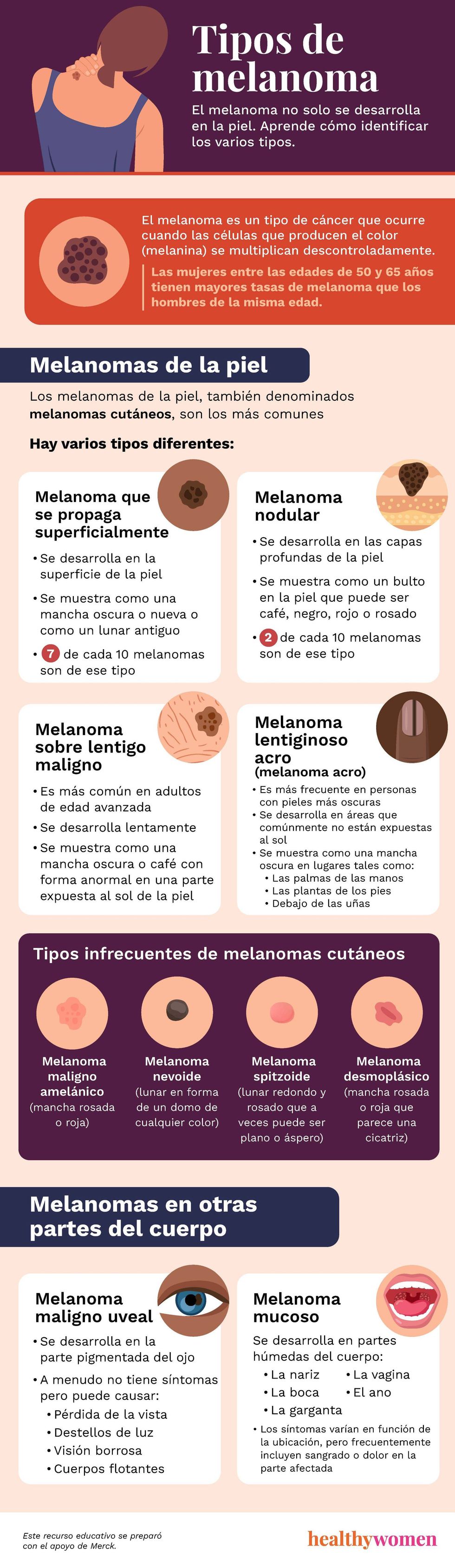 Tipos de melanoma infographic. click to view pDF