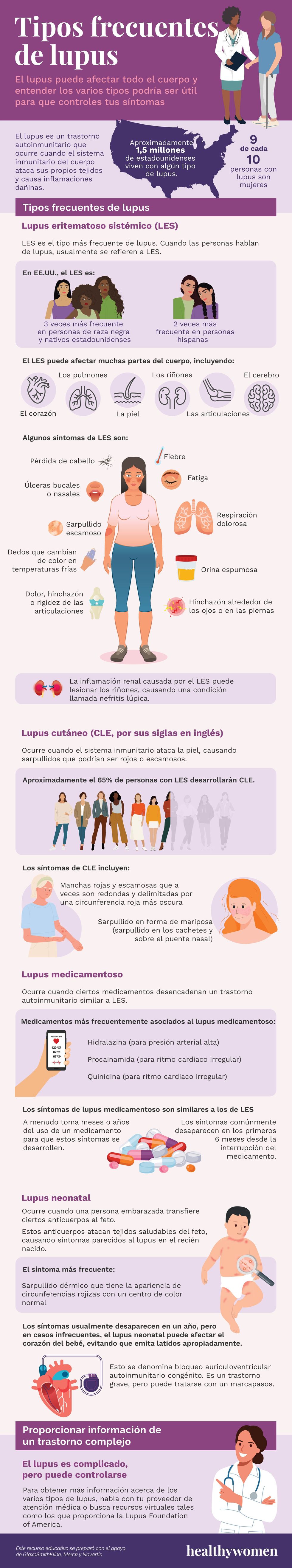 Tipos frecuentes de lupus