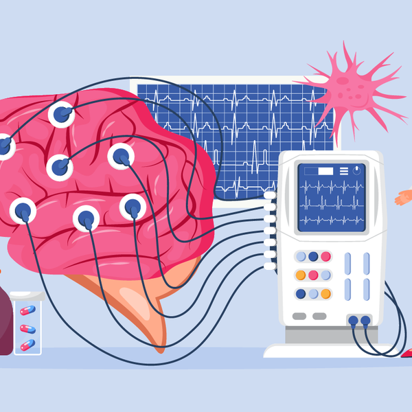 Tips for Living with Multiple Sclerosis (MS)