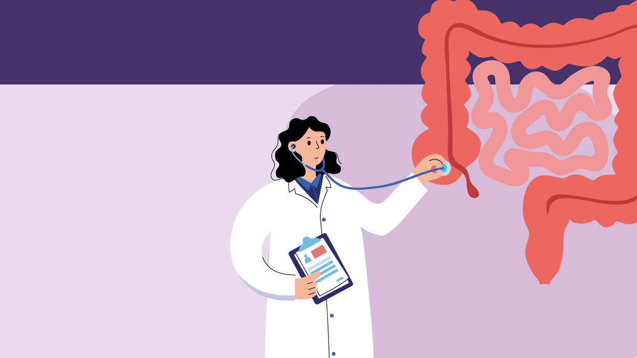 Treatment Options for Colon Cancer