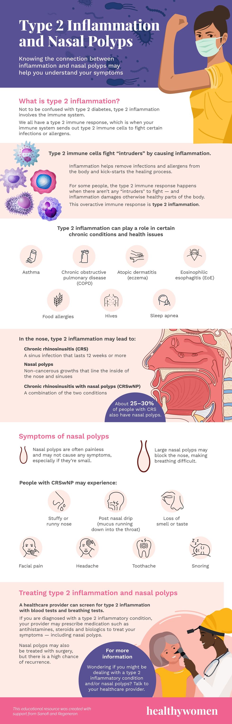 Type 2 Inflammation and Nasal Polyps Infographic. Click to view PDF